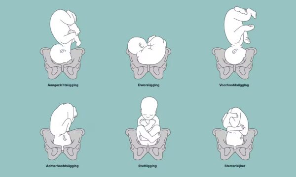 Ligging van je baby (bron: oudersvannu.nl)